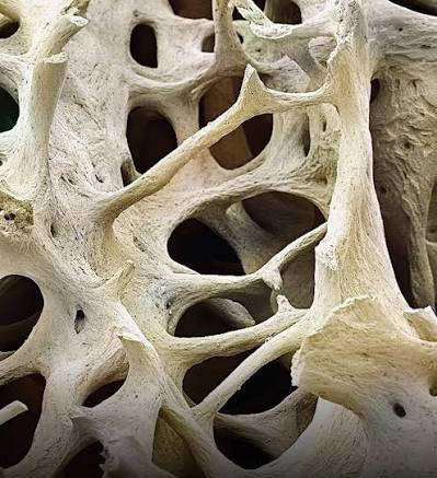 Hueso visto con microscopio electronico